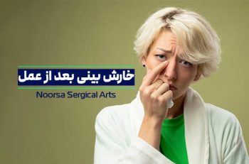 خارش بینی بعد از عمل بینی