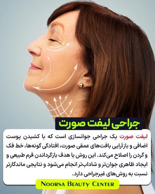 جراحی لیفت صورت