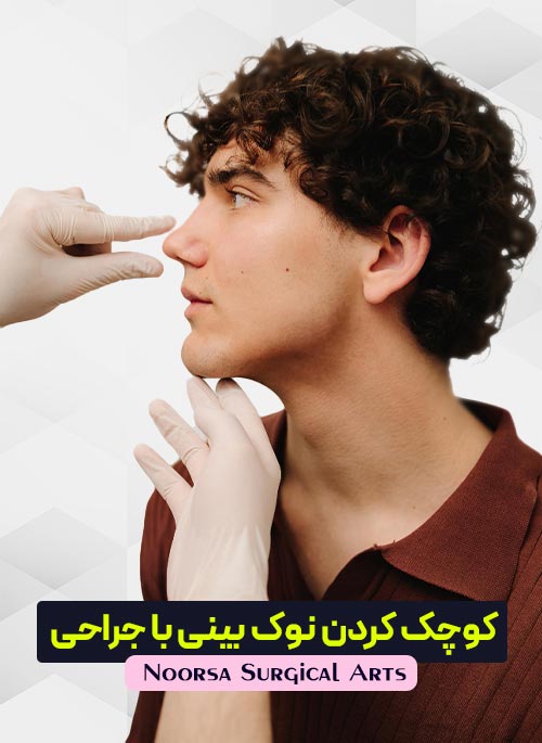 کوچک کردن نوک بینی با جراحی