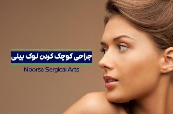 جراحی کوچک کردن نوک بینی