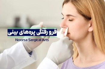 فرورفتگی پره های بینی