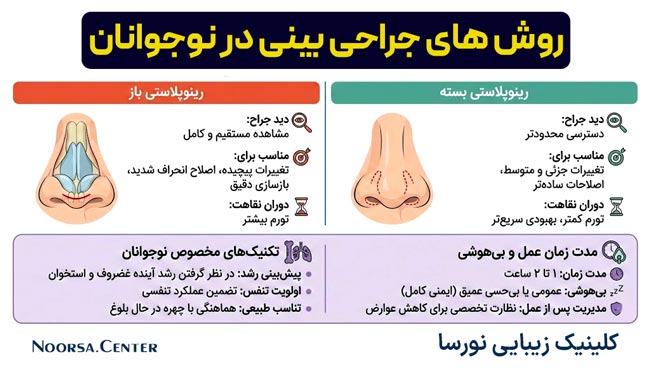 روش های جراحی بینی در نوجوانان
