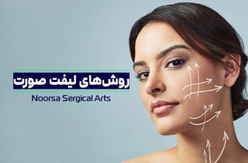 انواع روش های لیفت صورت