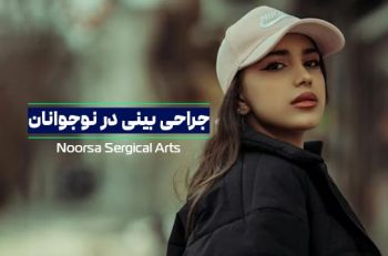 جراحی بینی در نوجوانان