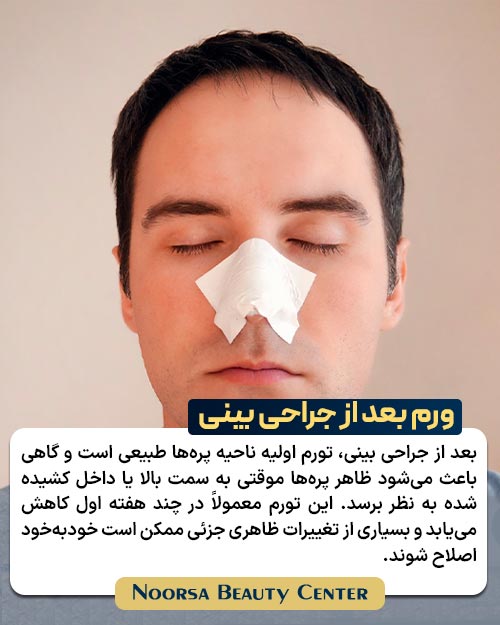 ورم بعد از جراحی بینی