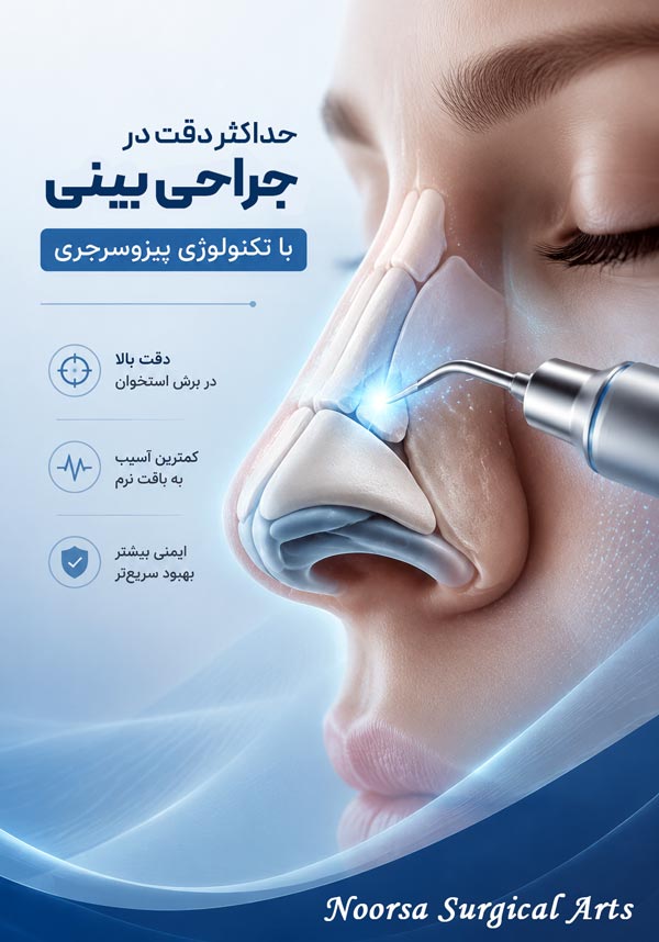 جراحی بینی با پیزوسرجری