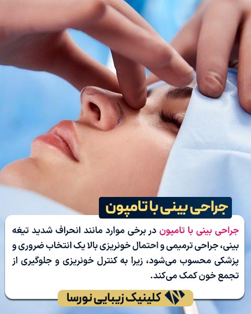 جراحی بینی با تامپون