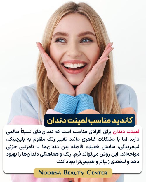 بهترین کاندید لمینت دندان