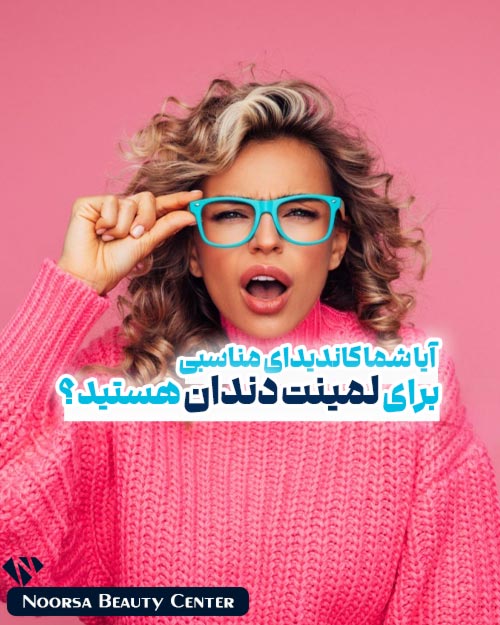 کاندیدای مناسب لمینت دندان