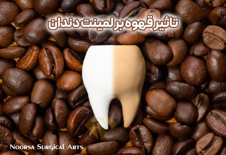 تاثیر قهوه بر لمینت دندان