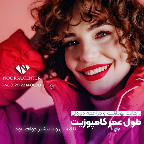 طول عمر کامپوزیت دندان تا 8 سال و یا بیشتر با رعایت نکات لازم