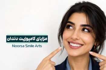مزایای کامپوزیت دندان