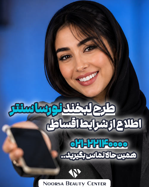 طرح لبخند کامپوزیت دندان