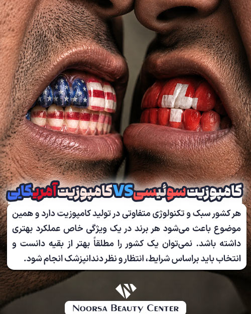 کامپوزیت آمریکایی یا سوئیسی