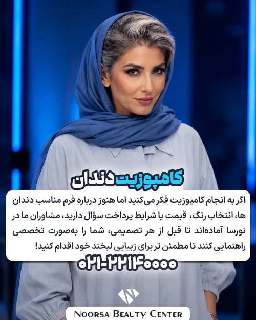 مشاوره کامپوزیت دندان