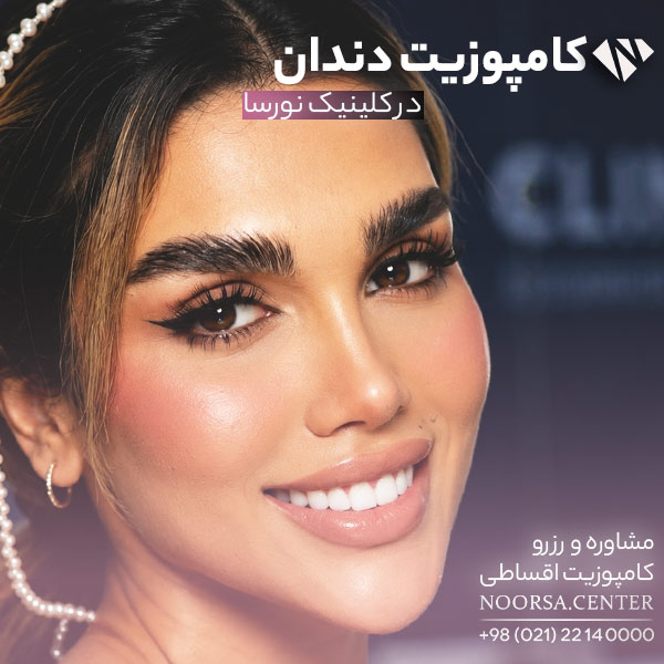 نمونه کامپوزیت دندان در کلینیک نورسا