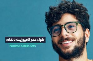 طول عمر کامپوزیت دندان