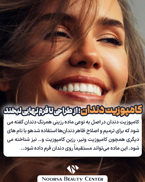 کامپوزیت دندان چیست