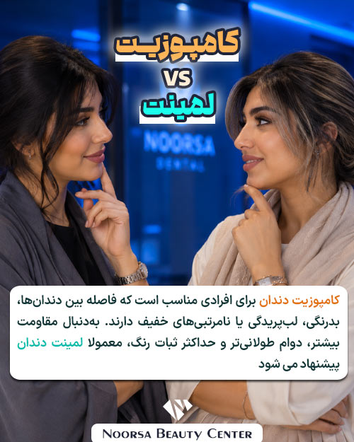 کامپوزیت دندان در مقایسه با لمینت دندان
