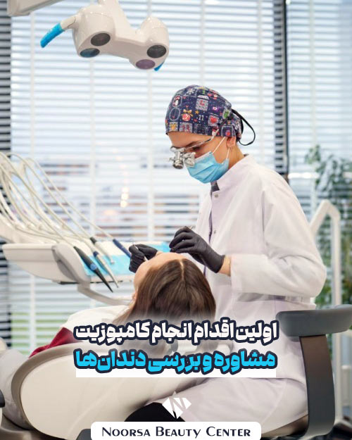 مشاوره کامپوزیت دندان