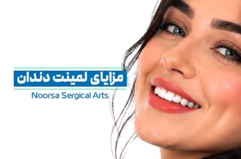 مزایای لمینت دندان