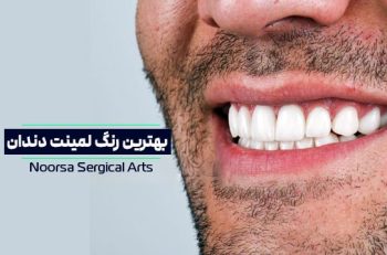 بهترین رنگ لمینت دندان