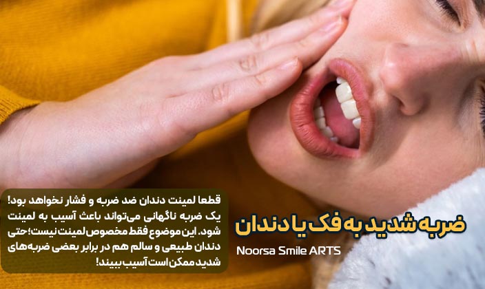 ضربه ناگهانی یا فشار شدید از علل شکستگی لمینت دندان