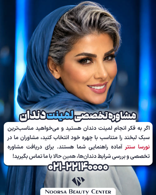 مشاوره لمینت دندان