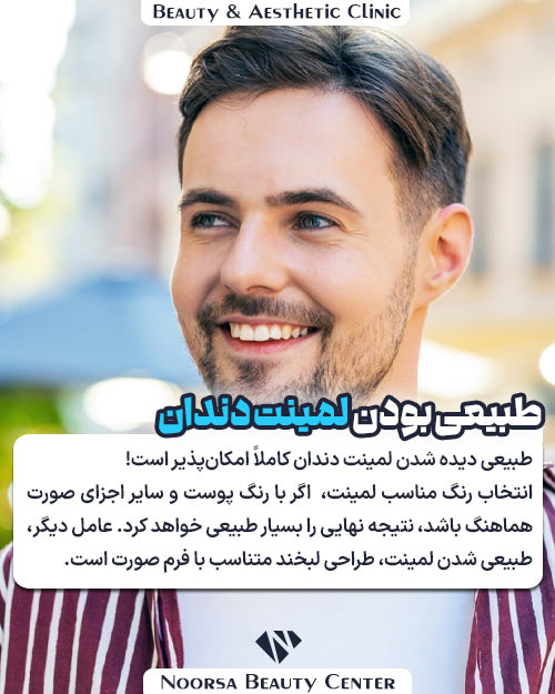 طبیعی دیده شدن لمینت دندان