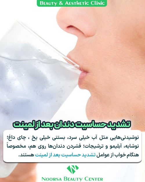 عوامل تشدید حساسیت دندان بعد از لمینت