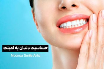 حساسیت دندان به لمینت