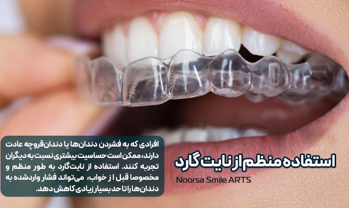 استفاده از نایت گارد حساسیت بعد لمینت دندان را کمتر میکند