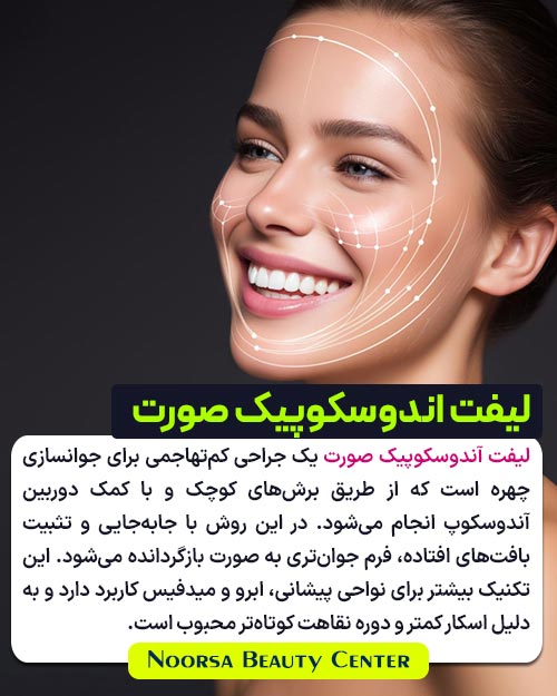لیفت اندوسکوپیک صورت چیست