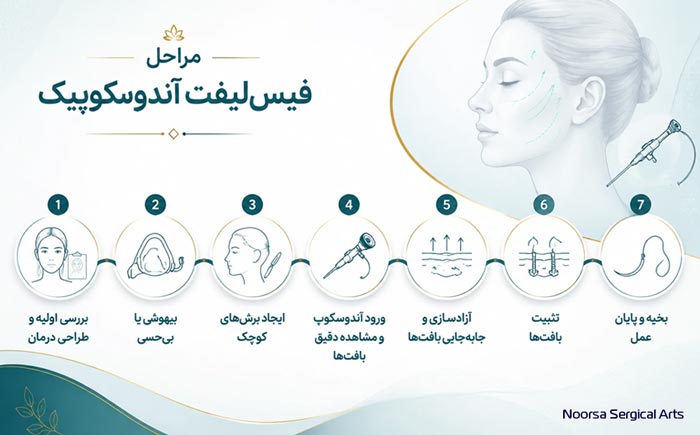 مراحل فیس لیفت اندوسکوپیک صورت