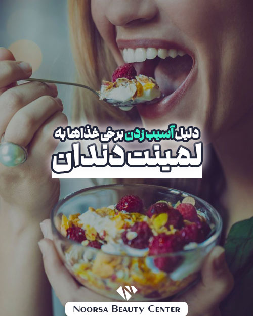 دلیل آسیب زدن برخی غذاها به لمینت دندان