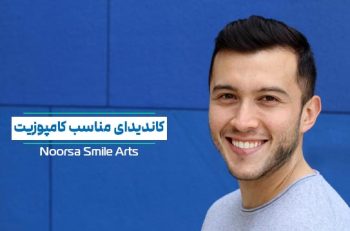 کاندیدای مناسب کامپوزیت دندان