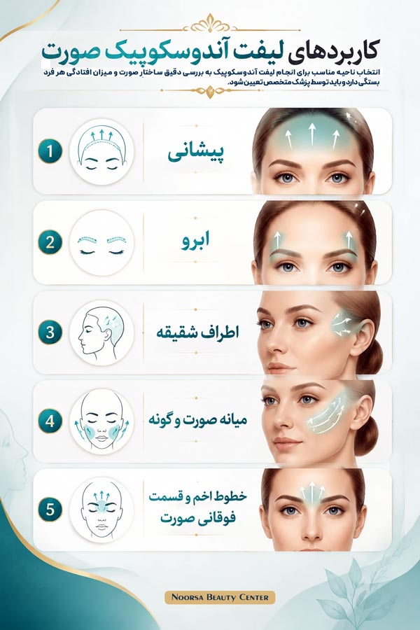 کاربردهای لیفت صورت اندوسکوپیک