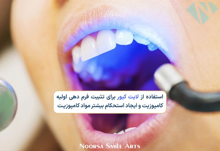 استفاده از لایت کیور برای استحکام کامپوزیت