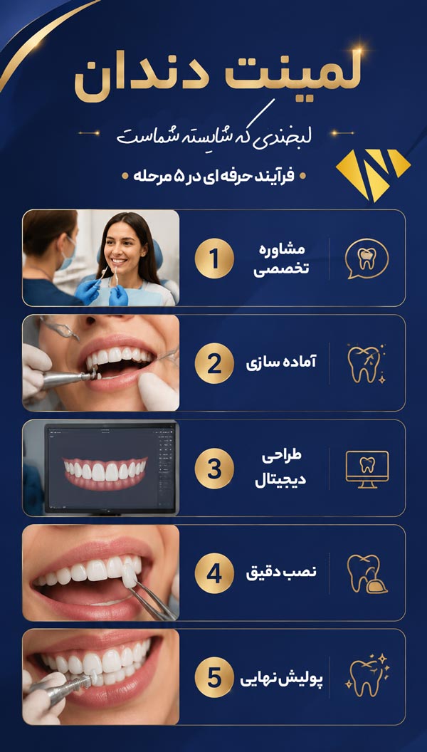 مراجل انجام لمینت دندان