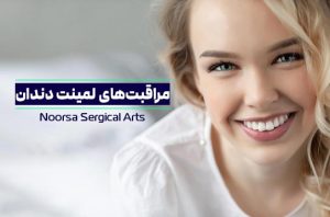 مراقبت های بعد از لمینت دندان