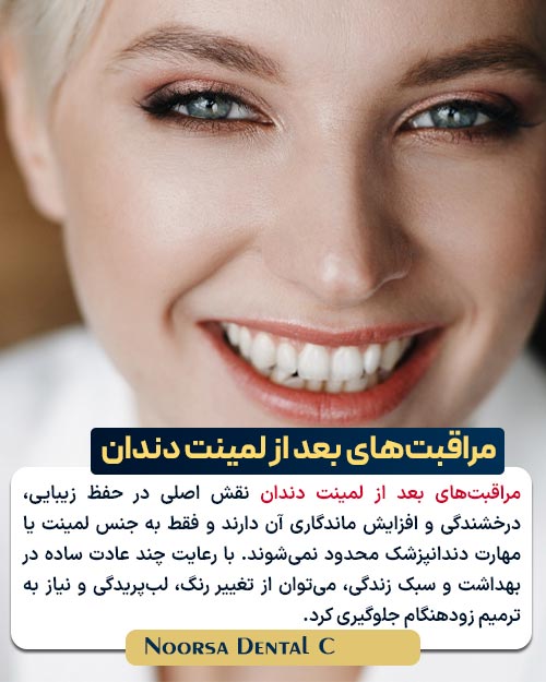 مراقبت های بعد از لمینت دندان