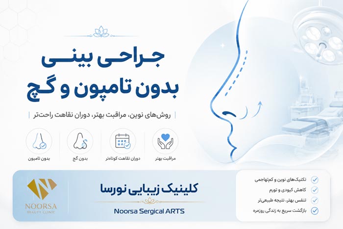 جراحی بینی بدون اسپلینت و تامپون
