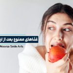 غذاهای ممنوع بعد از ارتودنسی دندان