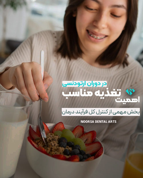 اهمیت تغذیه در دوران ارتودنسی