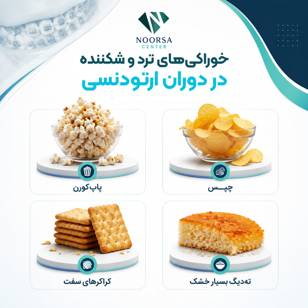 خوراکی های ترد در دوران ارتودنسی