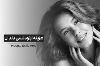هزینه ارتودنسی دندان