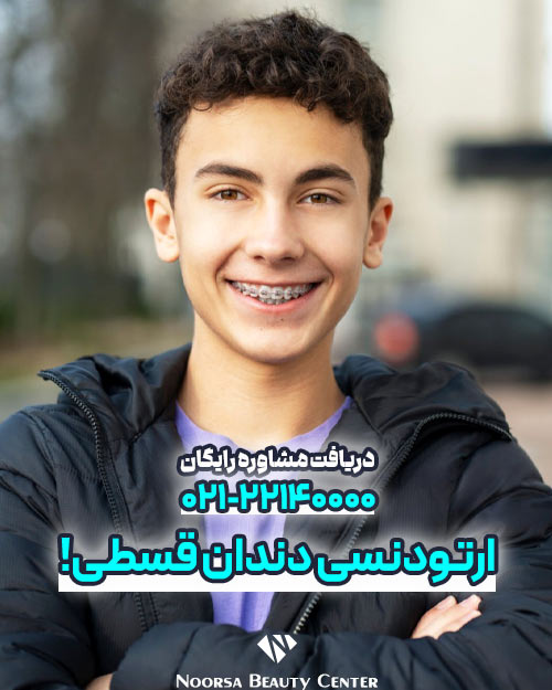 ارتودنسی اقساطی دندان