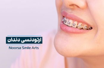 ارتودنسی دندان