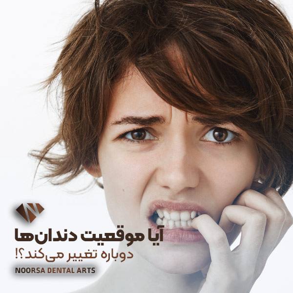 تغییر موقعیت دندان بعد از ارتودنسی