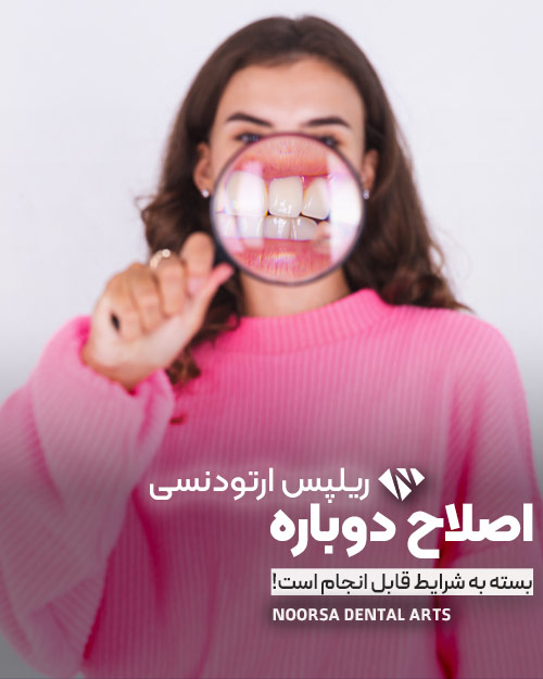 اصلاح بازگشت دندانها پس از ارتودنسی